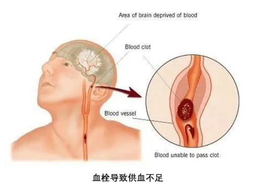 情侣种草莓科学指南，才能处处吻