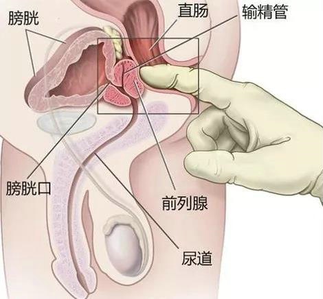 怎样保护好前列腺，提升床上战斗力