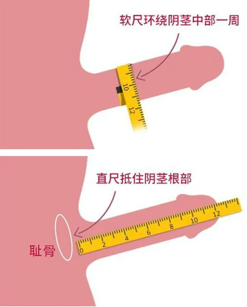 丁丁勃起时长度9cm，算正常吗？