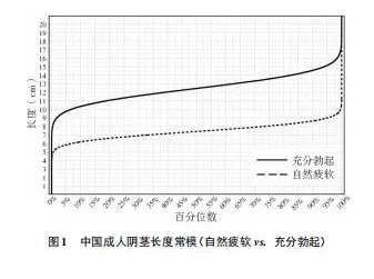 丁丁多大是标准？又该去怎么测量？