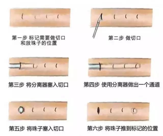 J8镶钻？不，那叫入珠