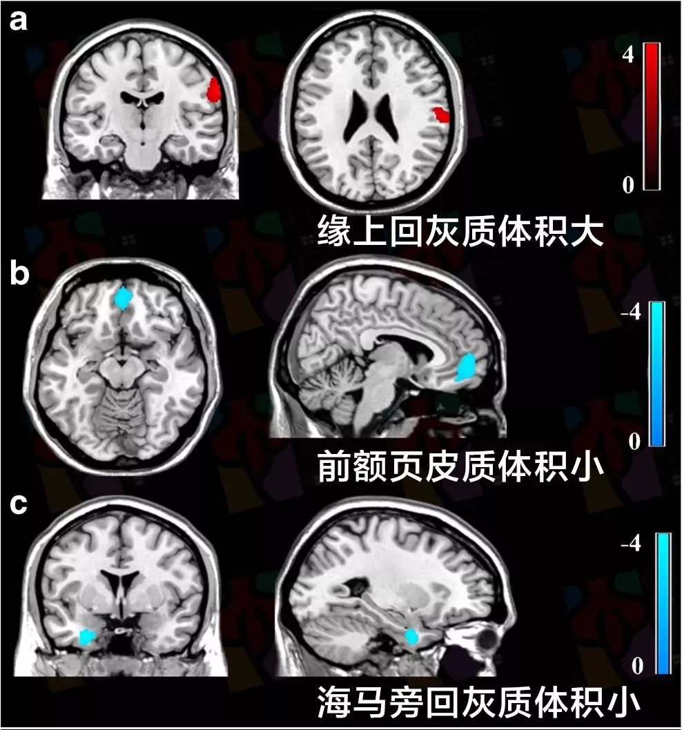 独生子是被宠坏的一代么？